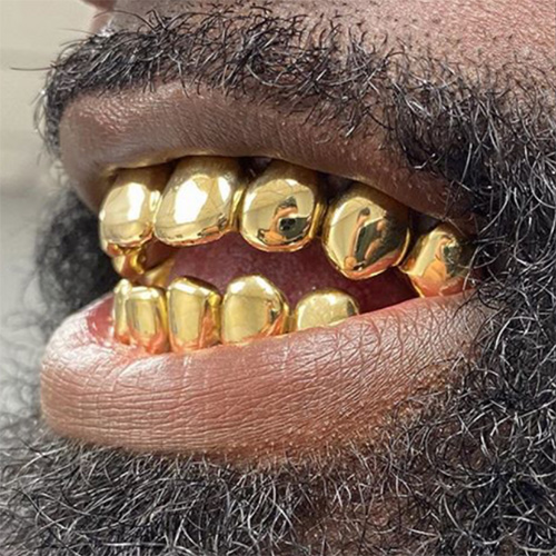 18k Gold Grillz – Grillz Pro