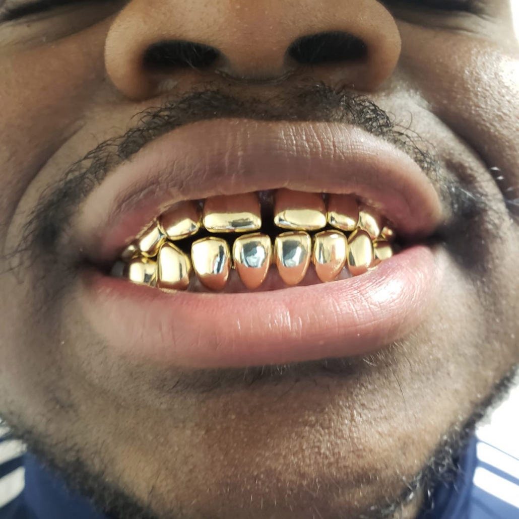 10K Solid Gold 8 Top & 8 Bottom – Grillz Pro
