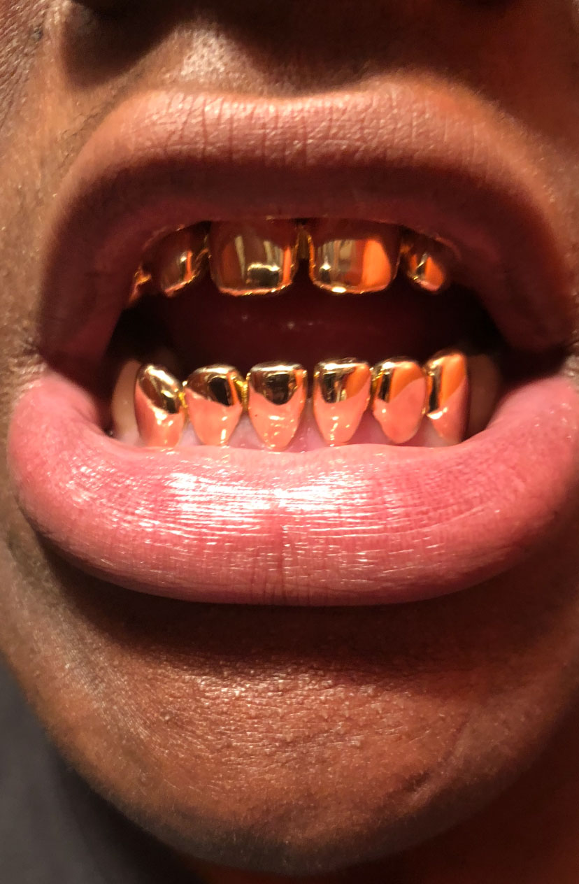 10K SOLID GOLD 6 TOP & 6 BOTTOM – Grillz Pro