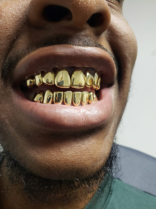 Our Gallery – Grillz Pro